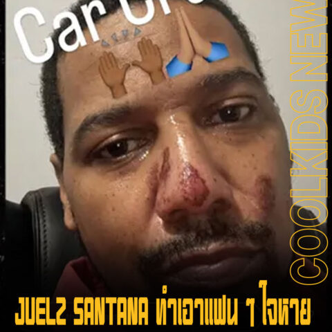 JUELZ SANTANA ทำเอาแฟน ๆ ใจหาย หลังโชว์ภาพอาการบาดเจ็บจากอุบัติเหตุรถชน หน้าหายไปแถบ
